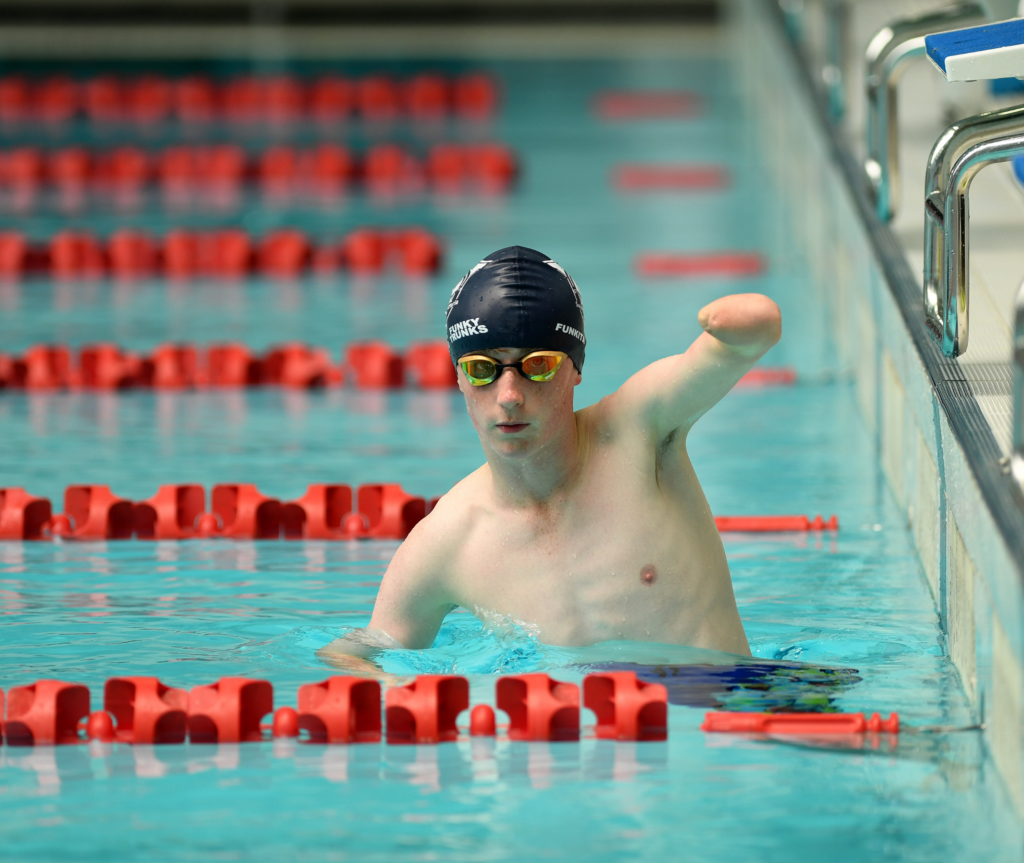 A swimmer is at the end of a swimming pool, wearing a black swimming cap and swimming goggles. The swimmer's right arm is raised, showing congenital hand differences with the hand missing below the wrist.